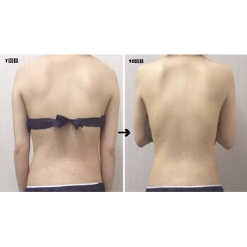 背中瘦せは早い？？