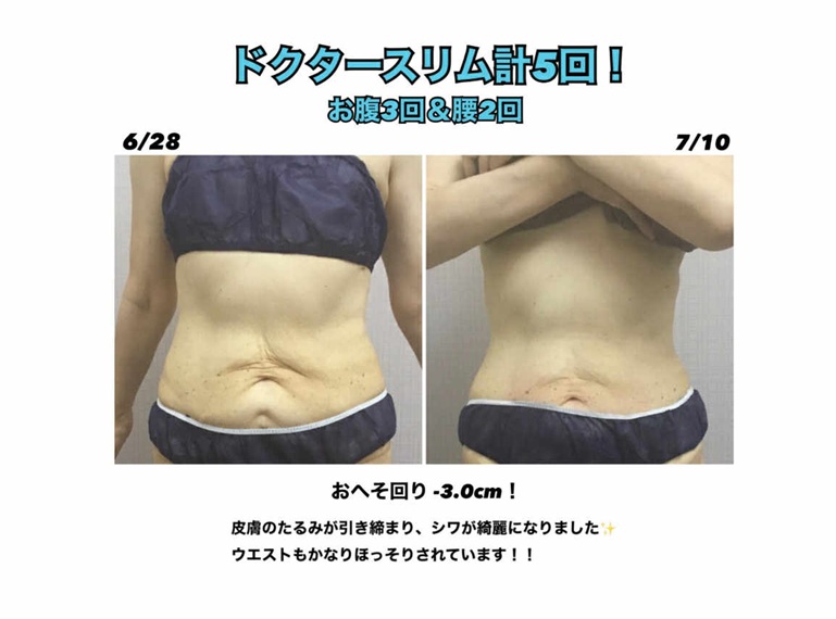 ドクタースリムの効果！！